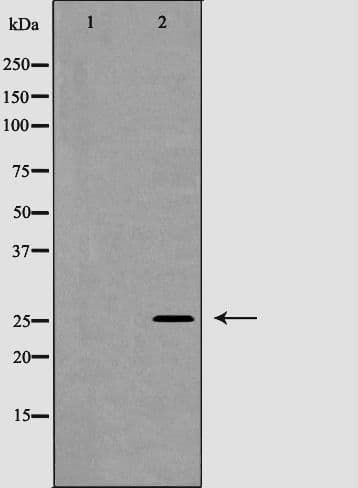 NGF Antibody