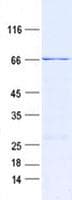 Human IFT74 / CCDC2 Protein (Recombinant His, N-Terminal)