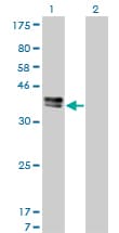 ISLET-1 / ISL1 Antibody (clone 1A3)