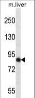NEK5 Antibody (aa525-552)
