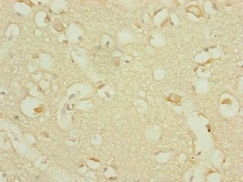 DHTKD1 Antibody