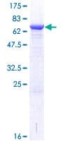 Human CHKB / CHKL Protein (Recombinant GST)