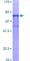 Human TUBA1B / Tubulin Alpha 1B Protein (Recombinant GST)