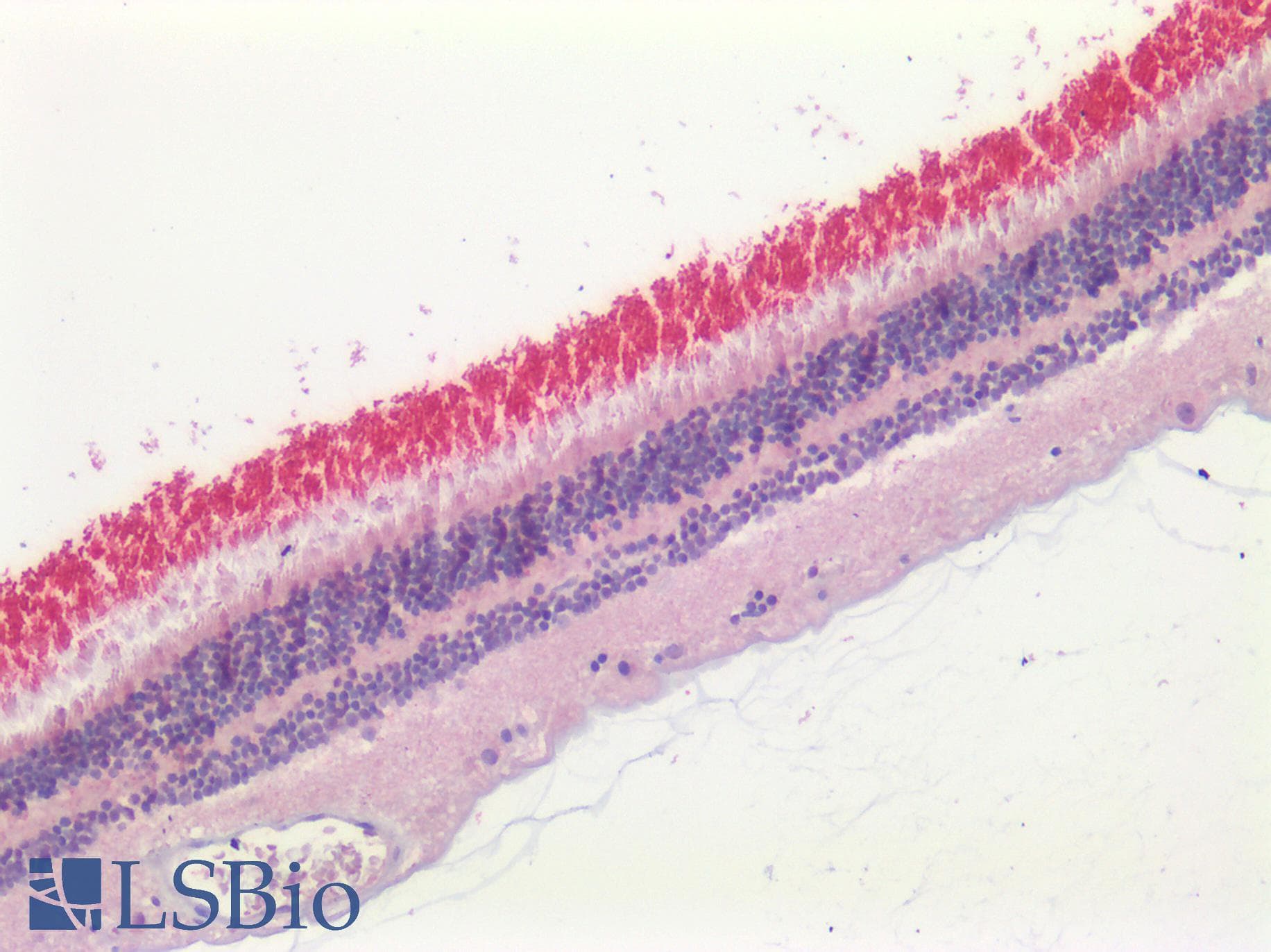 PathPlus™ Polyclonal Rabbit anti-Human ABCA4 Antibody (C-Terminus, IHC)