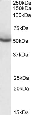 IHC-plus™ Polyclonal Goat anti-Human PPARD / PPAR Delta Antibody (aa430-441, IHC, WB)