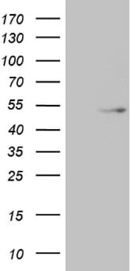 TRDMT1 / DNMT2 Antibody (aa84-293, clone OTI8H10)