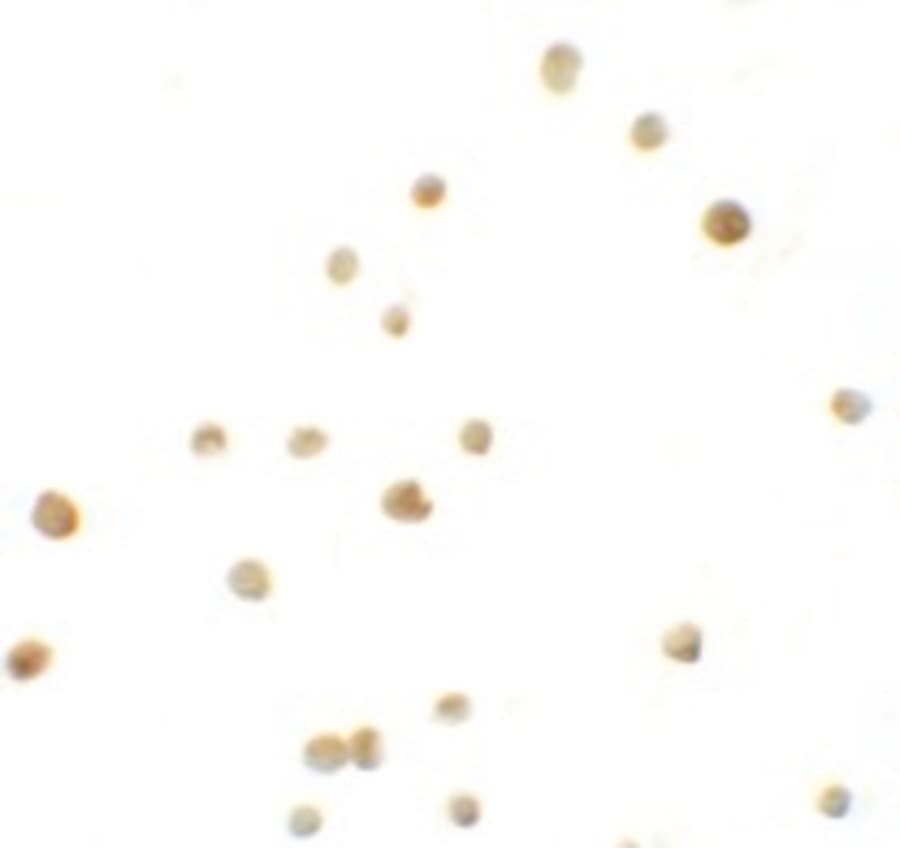 IHC-plus™ Polyclonal Rabbit anti-Human IRF4 Antibody (IHC, IF, WB)