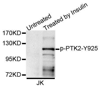 FAK / Focal Adhesion Kinase Antibody (phospho-Tyr925)