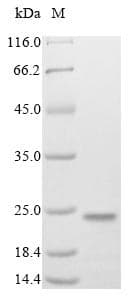 Mouse MAFK Protein (Recombinant 10His, N-terminus + Myc, C-terminus)