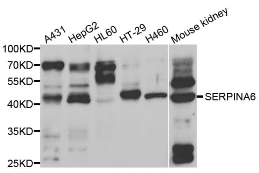 IHC-plus™ SERPINA6 / CBG Antibody
