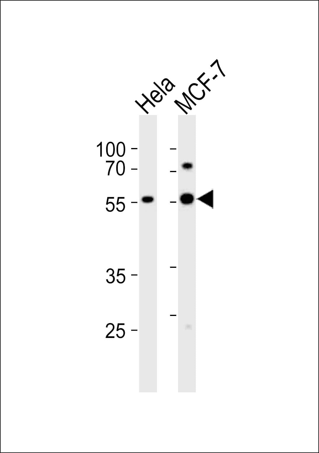 GATA6 Antibody (aa551-585)