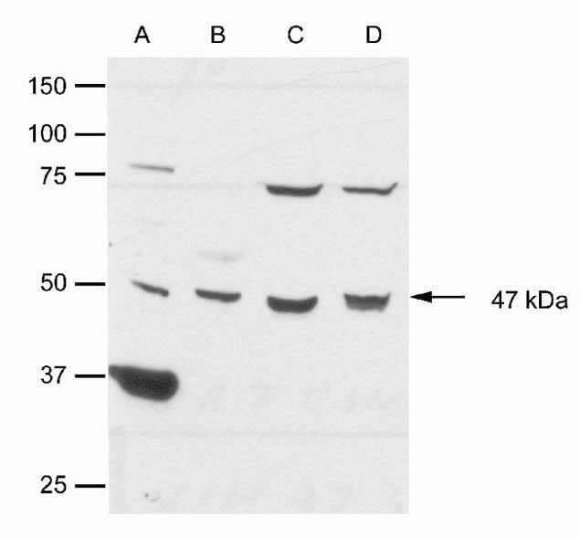 CSNK1E / CK1 Epsilon Antibody (N-Terminus)