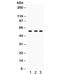 CYP27B1 Antibody
