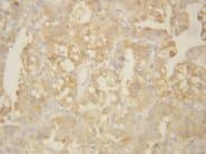 MMP9 / Gelatinase B Antibody (aa689-705)
