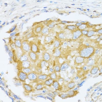 Polyclonal Rabbit anti-Human MAPK10 / JNK3 Antibody (IHC, WB)