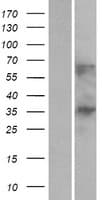 Human C1orf198 Protein (Over-Expression Lysate Myc-DDK (Flag))