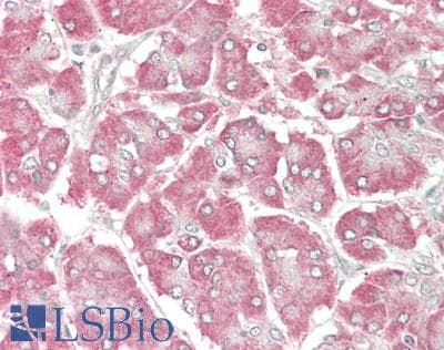 IHC-plus™ Polyclonal Rabbit anti-Human MYO5C Antibody (IHC, WB)
