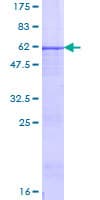Human PRSS1 / Trypsin Protein (Recombinant GST)