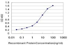 IHC-plus™ RPS6KB2 / S6K2 Antibody (clone 4B11)