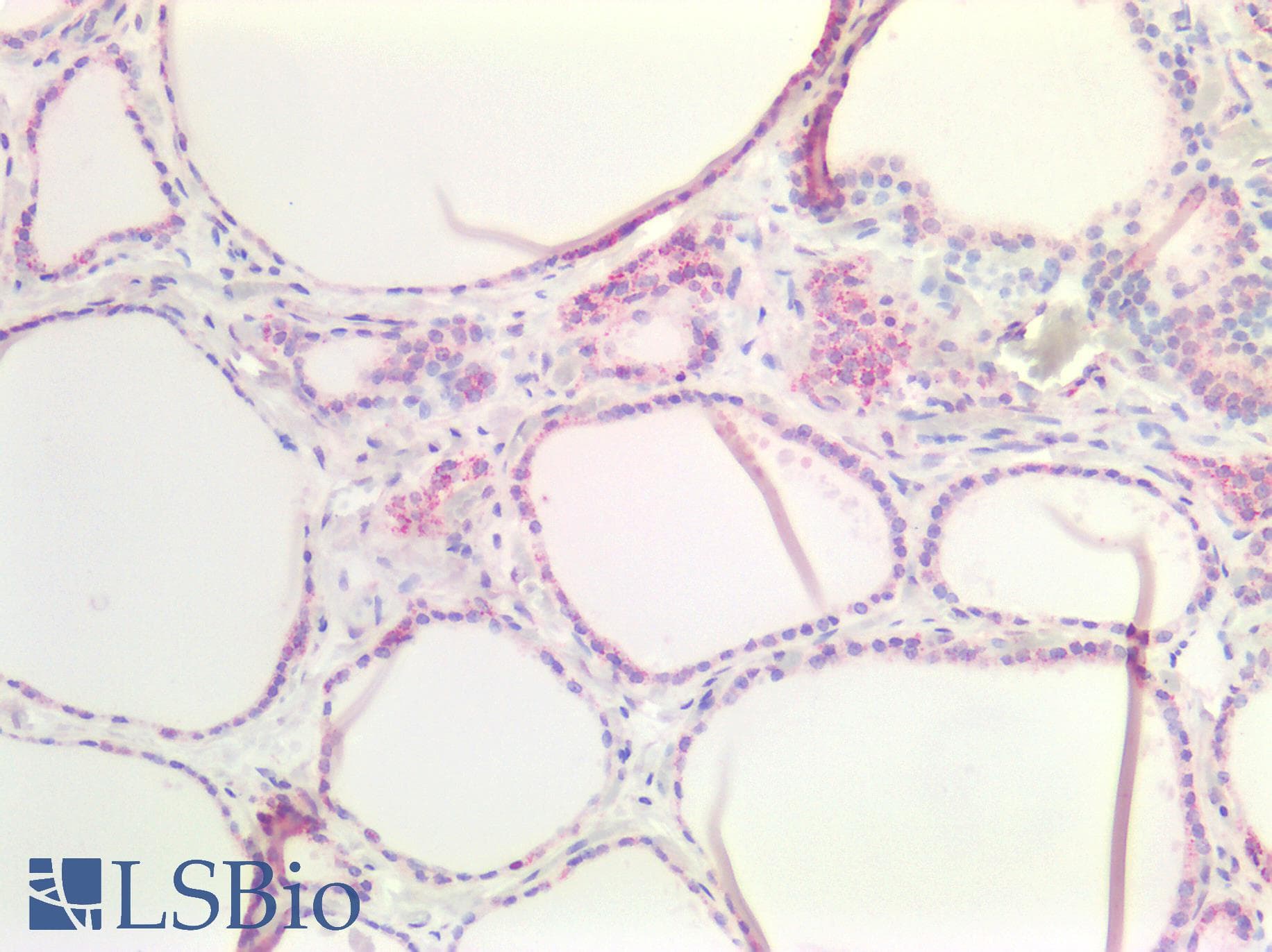 PathPlus™ Polyclonal Rabbit anti-Human CLDN3 / Claudin 3 Antibody (IHC)