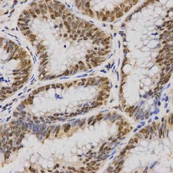 IHC-plus™ Polyclonal Rabbit anti-Human SKIV2L2 Antibody (IHC, WB)