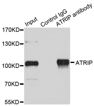 ATRIP Antibody