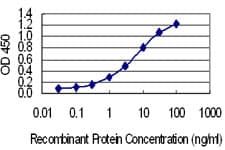 Monoclonal Mouse anti-Human SSX4 Antibody (clone 3E10, IF, WB)