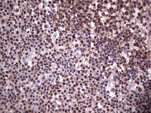 PPP1R8 / Rnase E Antibody (aa1-225, clone OTI4D5)