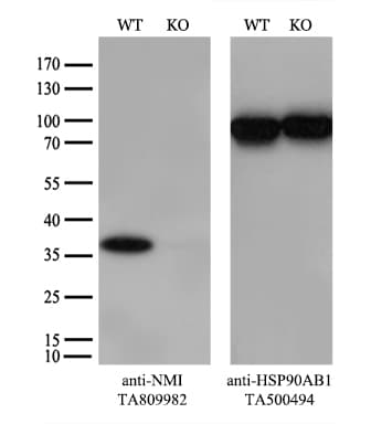 NMI Antibody (aa1-223, clone OTI2C1)