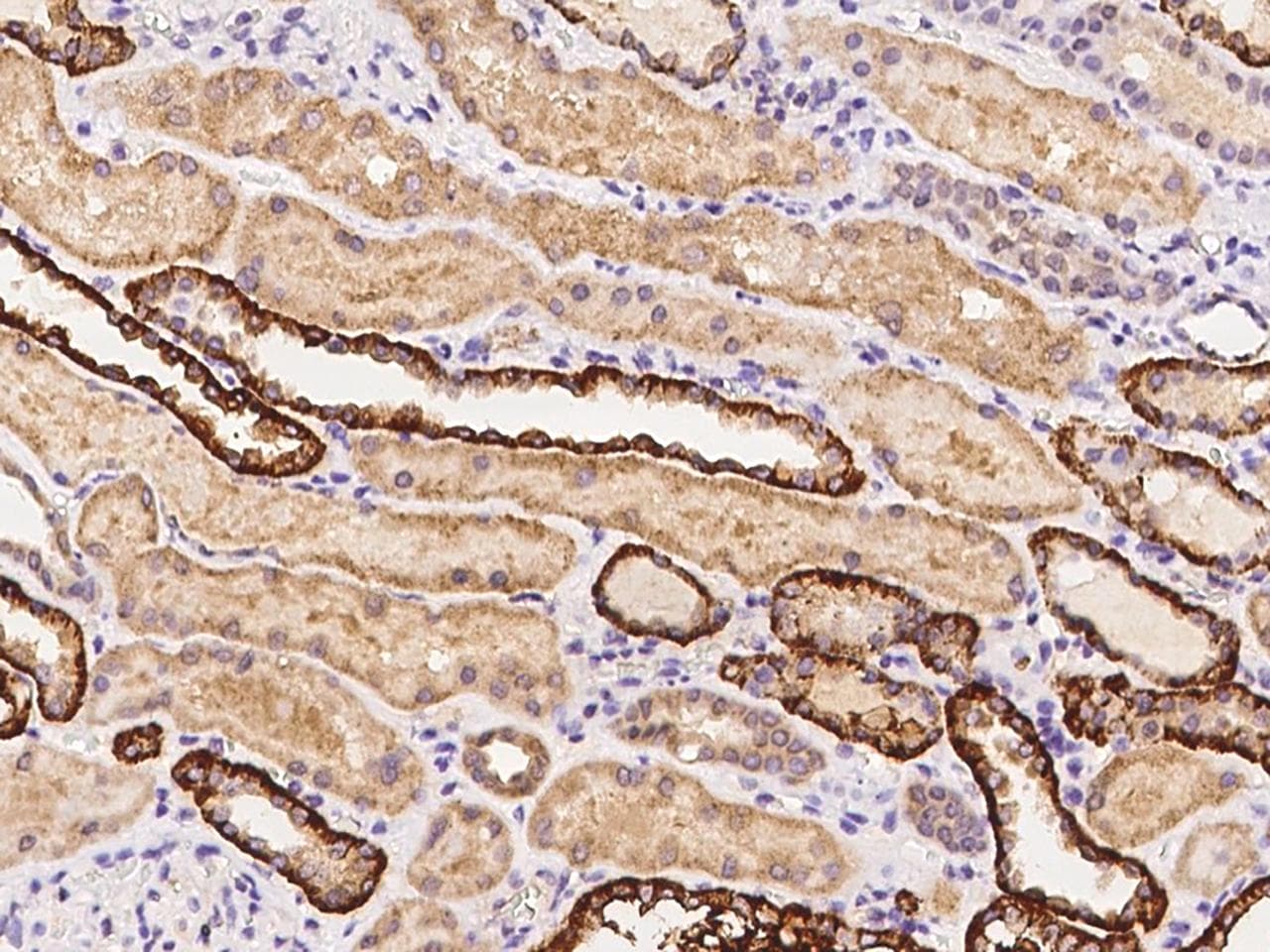 HTR3B / 5-HT3B Receptor Antibody