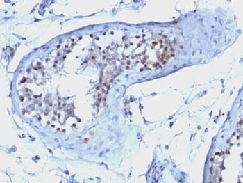 CCNB1 / Cyclin B1 Antibody (clone CCNB1/1098)