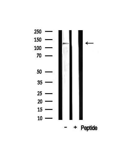 MAST205 / MAST2 Antibody