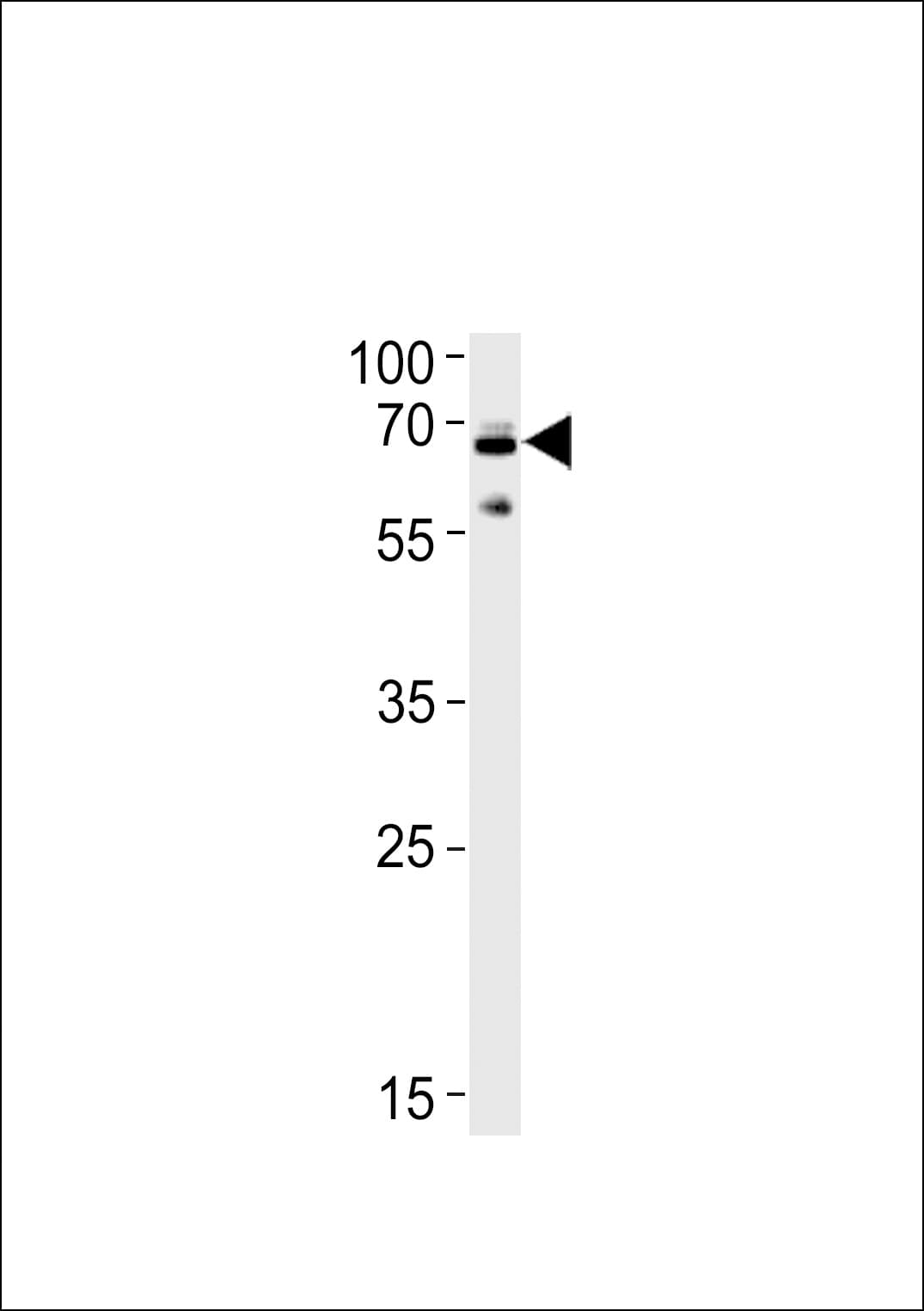 UBQLN1 / Ubiquilin Antibody (aa296-326)