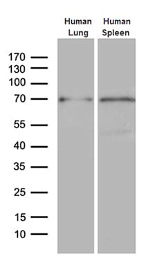 ALOX5 / 5-LOX Antibody (aa18-364, clone OTI1A1)