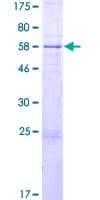 Human ANKRD9 Protein (Recombinant GST)