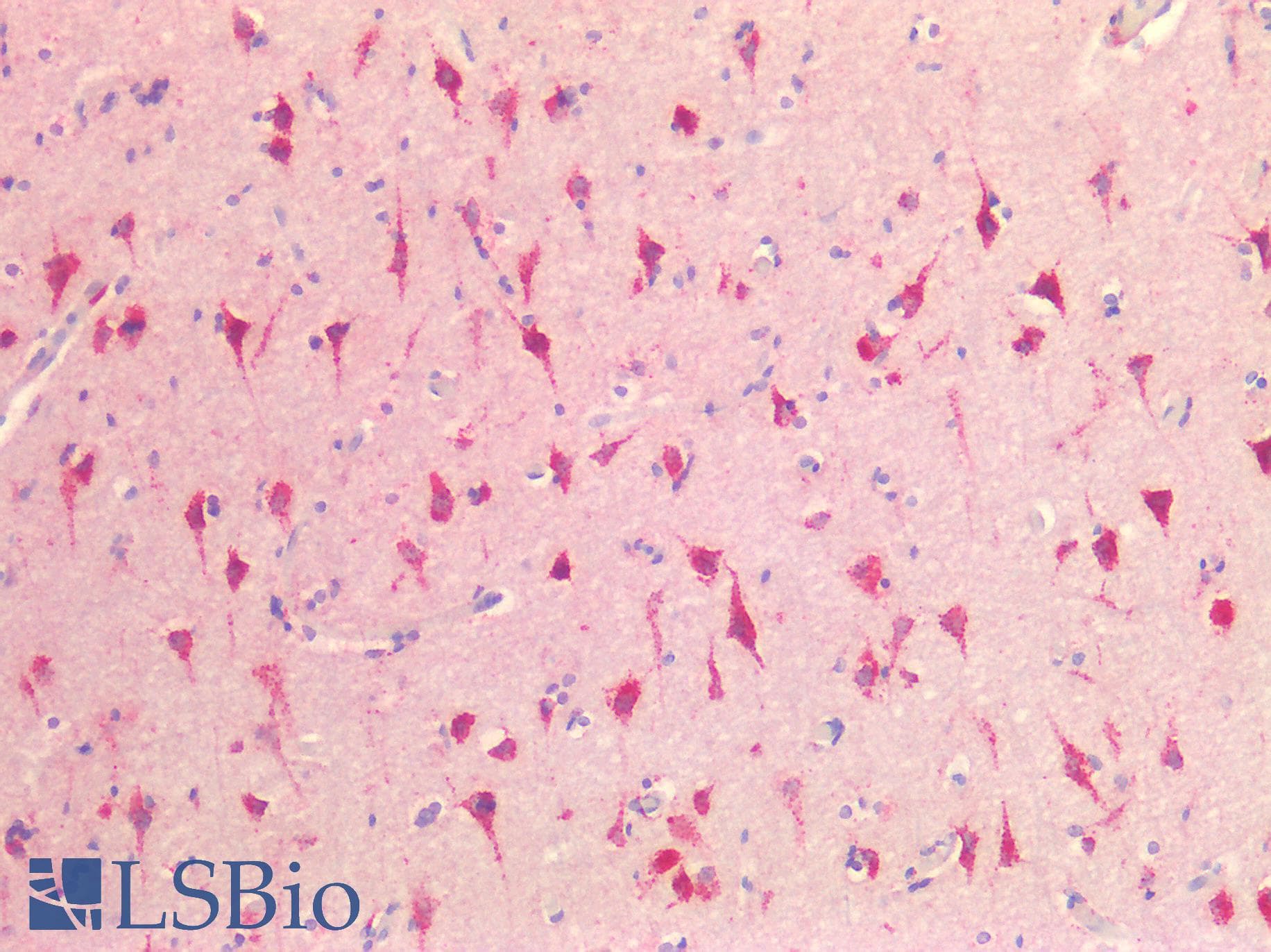 IHC-plus™ Polyclonal Rabbit anti-Human EPDR / EPDR1 Antibody (IHC, WB)