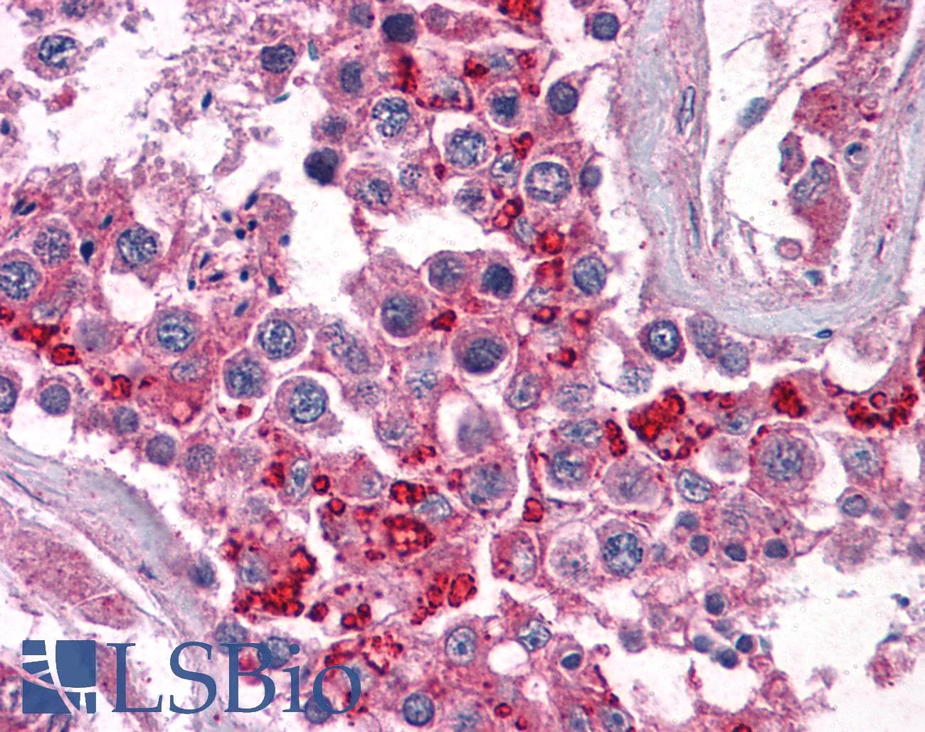 IHC-plus™ BIRC3 / cIAP2 Antibody