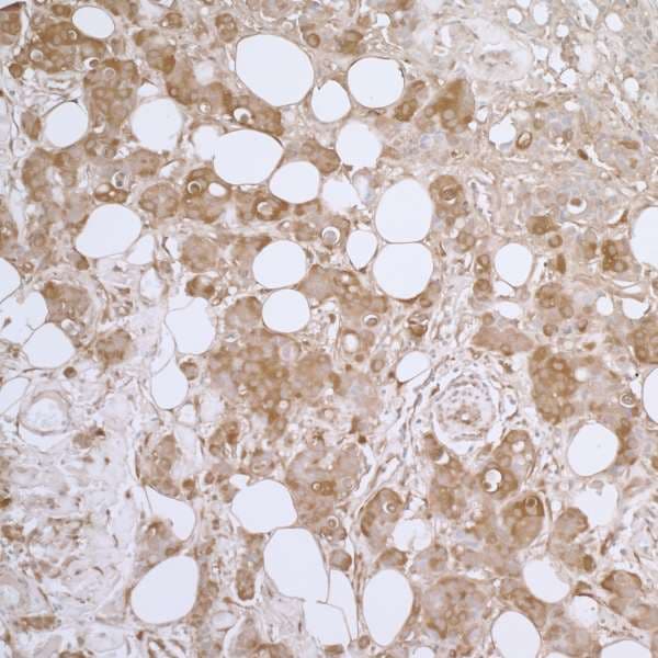 Polyclonal Rabbit anti-Human HSPB1 / HSP27 Antibody (aa155-205, IHC, WB)