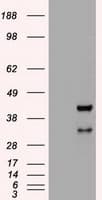 HHEX / HEX Antibody (clone OTI3E6)