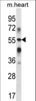 GLCT2 / B3GALT2 Antibody (aa394-422)