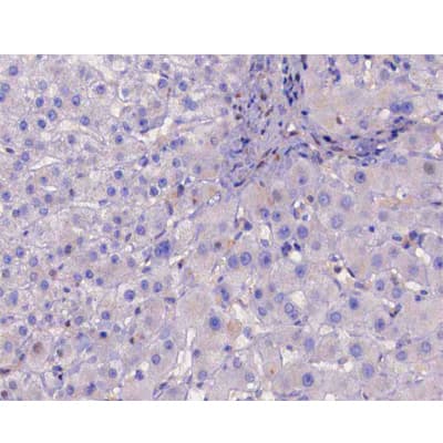 IKBKB / IKK2 / IKK Beta Antibody (phospho-Tyr188)