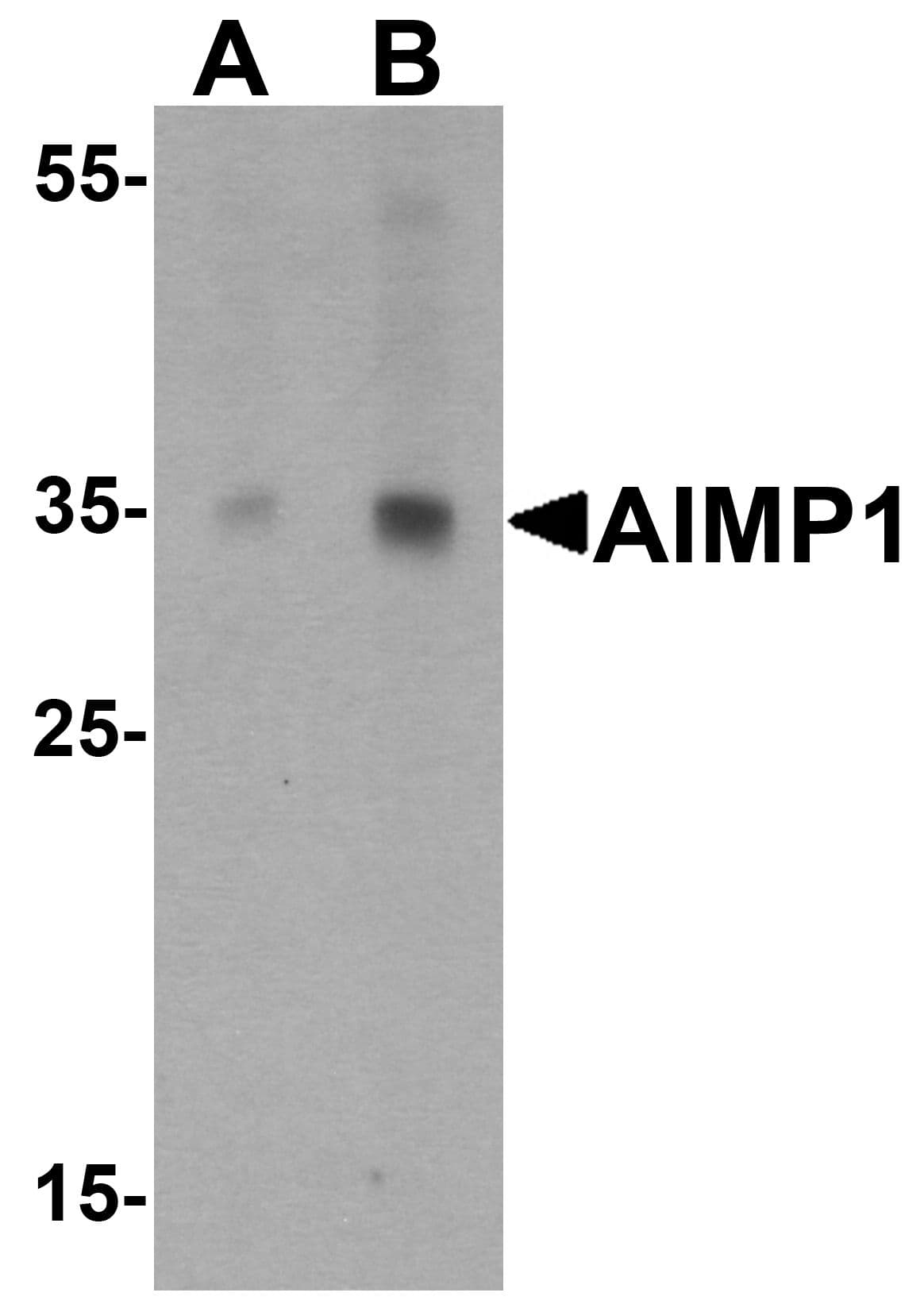 IHC-plus™ Polyclonal Rabbit anti-Human AIMP1 / EMAP II Antibody (IHC, WB)