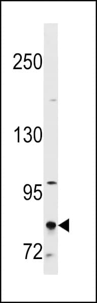 CTAGE1 / CTAGE Antibody (aa386-414)