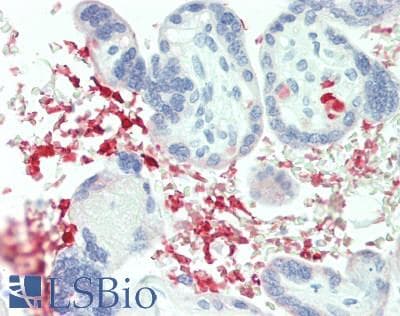 IHC-plus™ MELK Antibody (aa525-575)