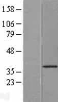 CTSO Protein (Over-Expression Lysate Myc-DDK (Flag))
