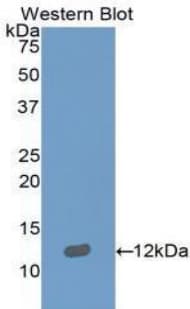 S100B / S100 Beta Antibody (aa1-92, Biotin)