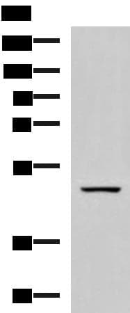 Polyclonal Rabbit anti-Human GFRA1 / GFR Alpha Antibody (IHC, WB)