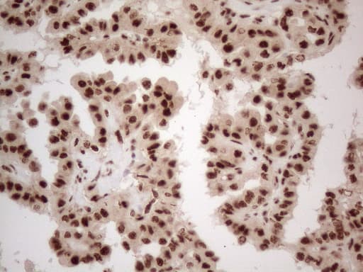 IRS1 Antibody (aa1-280, clone OTI3G10)