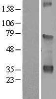 WDR54 Protein (Over-Expression Lysate Myc-DDK (Flag))