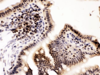 CCNT1 / Cyclin T1 Antibody